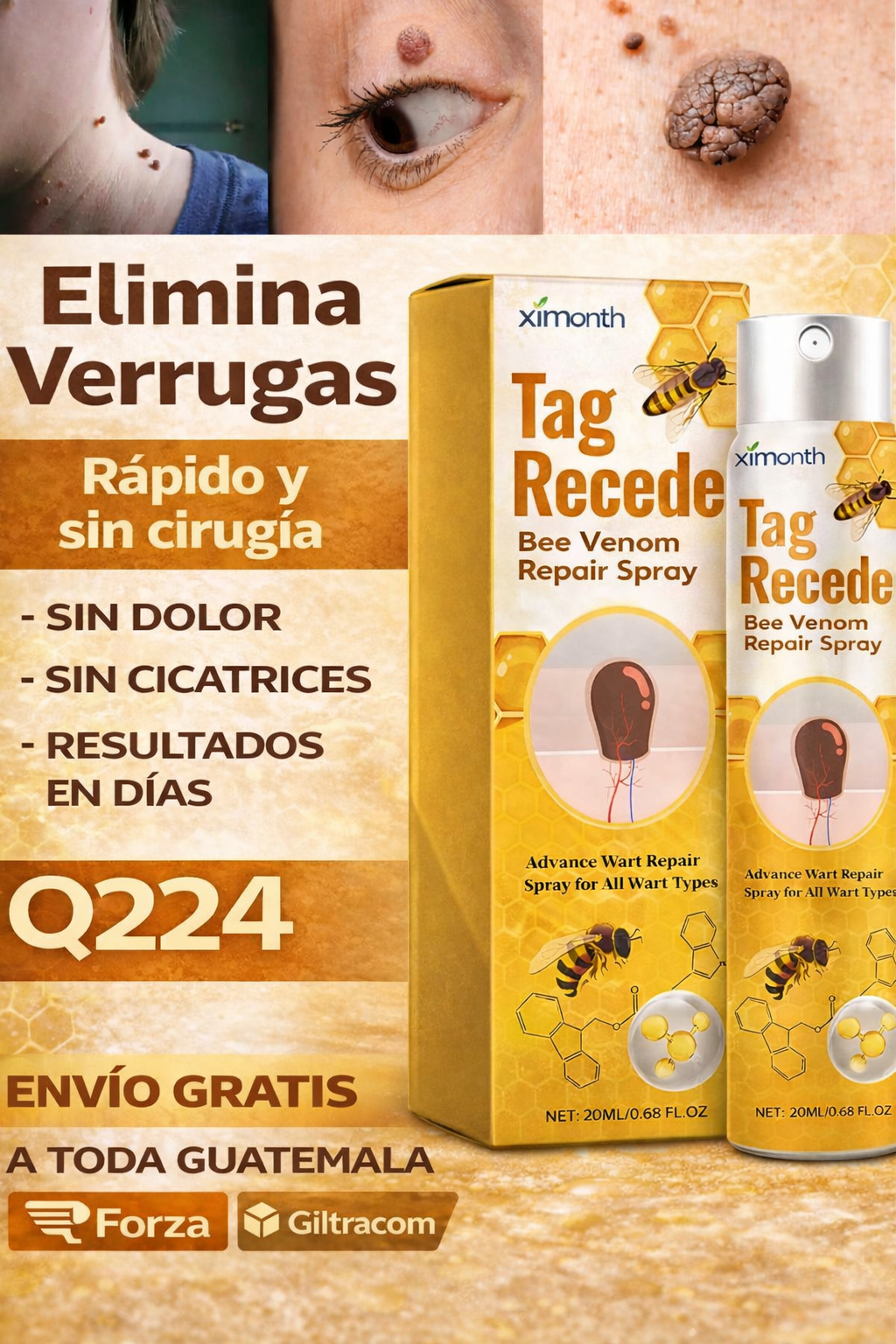 Elimina verrugas sin dolor, desde casa y sin gastar de más.